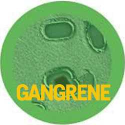 Gangrene Disease