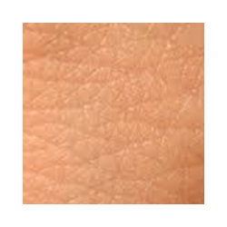 Skin Infections  Cures