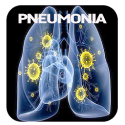 تطبيق Pneumonia Disease