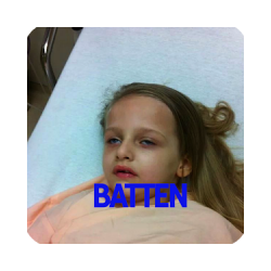 Batten Disease